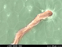 SEM image of a parasite on Rainbow Trout